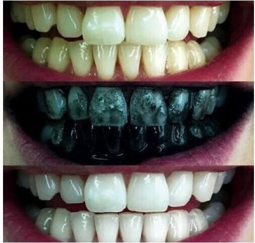 Glorysmile Пудра за избелване на зъби 30гр