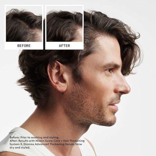 Anti-Haarverlust Bruch Set Nioxin System 2 Shampoo 300ml + Konditionierer 300ml + Behandlung 100ml