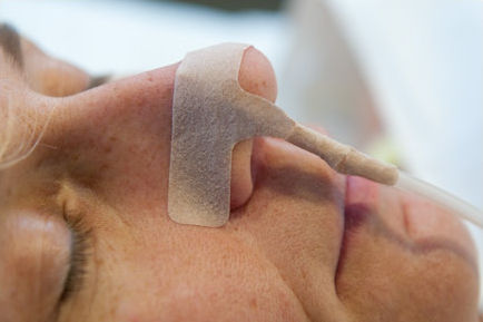 Nobamed Cateter Levin în culoarea Maro 50buc