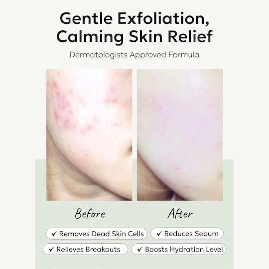 Celimax Peeling for Face & Lips in 60 Pads for Sensitive Skin