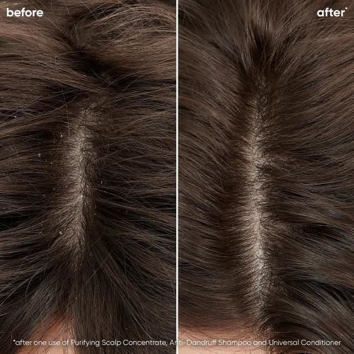 Matrix Scalp Sync Universal Conditioner 200ml