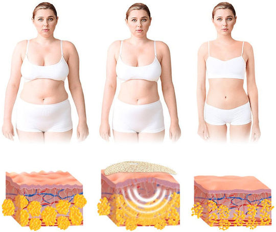 Set 5 Zola Liposuction Slimming Patches 31.5 X 17.7 Cm Made Natural Extracts