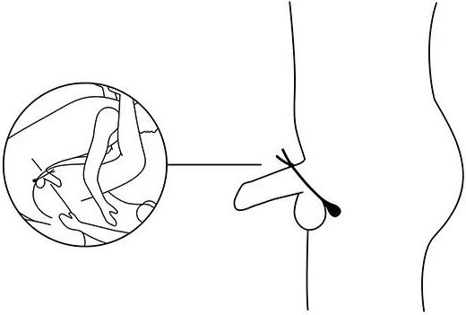 Nexus Vibrating Adjustable Lasso Cock Ring Black