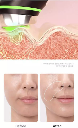 Medicube AGE-R Booster Pro Αnti-ageing / Firming / Pore Tightening Light Therapy Device Face LED Pink