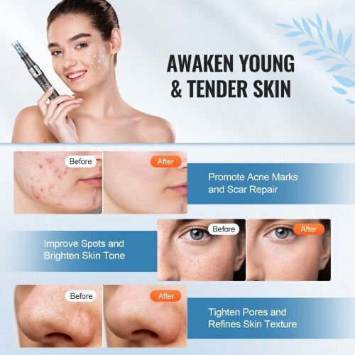 Vevor Συσκευή Microneedling NMWZ63K16Z3K9RUEGV2