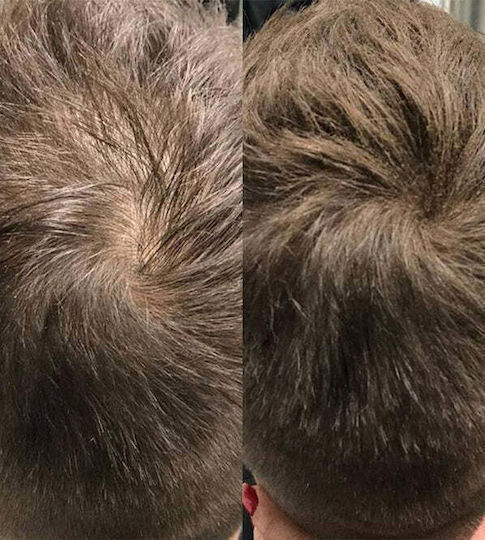 Beaver Fibre Acoperirea Subțierii Părului cu keratină Hair Building Fibers Beaver 12gr