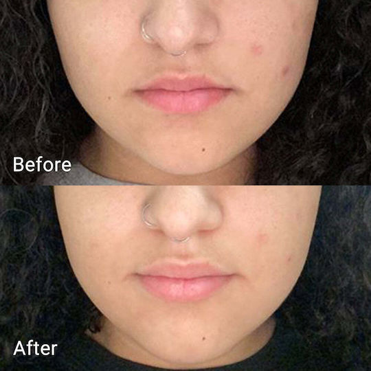 Aprilskin Gel Real Calendula Peel Off Demachiante Facial 100gr