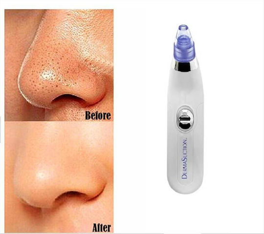 Dermasuction Συσκευή Περιποίησης Προσώπου για Καθαρισμό