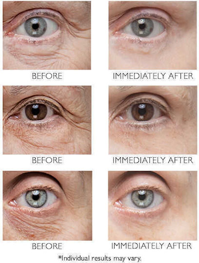 Peter Thomas Roth Instant Firm Augenbefeuchter für Festigung 30ml