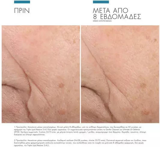 Triple Lipid 2:4:2 Rich Cremă Față 48ml