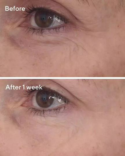 Murad Retinal Resculpt Overnight Treatment Ενυδατική & Αναπλαστική Κρέμα Προσώπου Νυκτός με Ρετινάλη 30ml