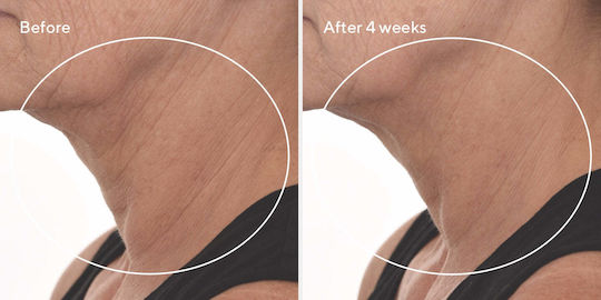 Murad Retinal Resculpt Overnight Treatment Ενυδατική & Αναπλαστική Κρέμα Προσώπου Νυκτός με Ρετινάλη 30ml