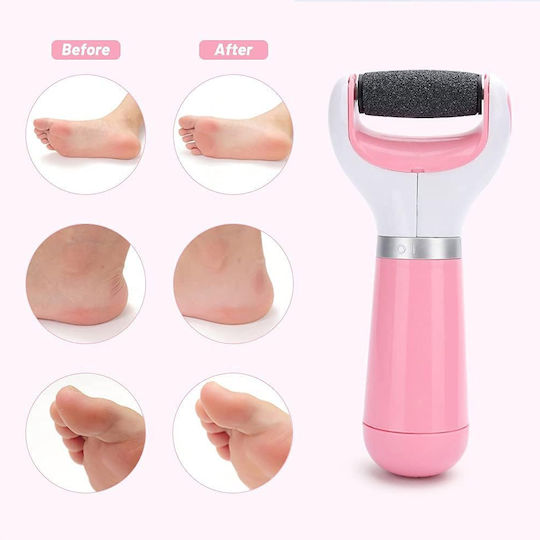 Rechargeable Electric Foot File for Heels & Calluses Dx-20