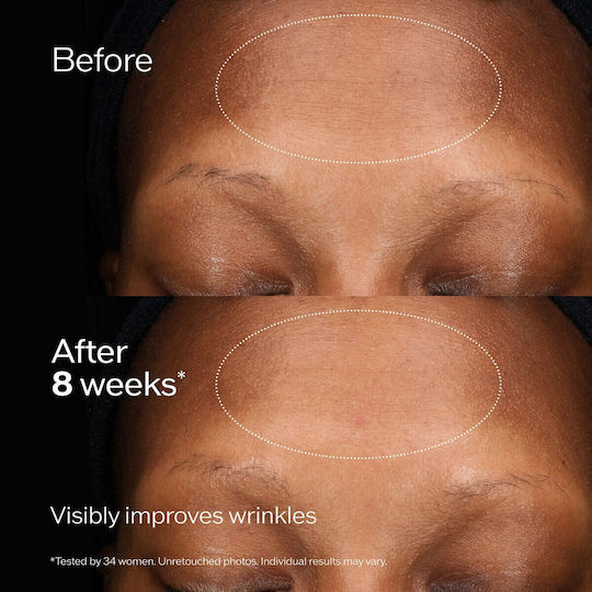 Shiseido Future Solution LX Cremă De Față 24 Ore Pentru Hidratare, Anti-Îmbătrânire & Tonifiere Cu Acid Hialuronic & Vitamina C 50ml