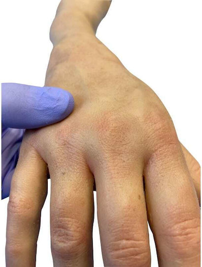 Erler Zimmer Appendages & Joints Model