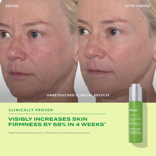 Murad Youth Renewal Αντιγηραντικό Serum Προσώπου με Ρετινόλη για Αποτοξίνωση 30ml
