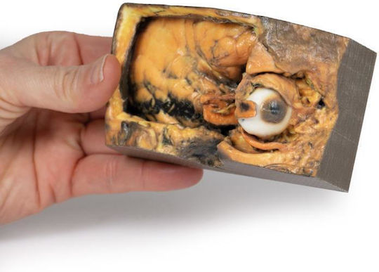 Erler Zimmer Internal Organs Model