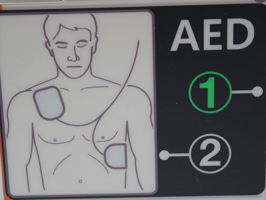 CU Medical IPAD CU-SP1 Semi-Automatic Defibrillator