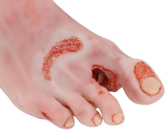 Training Manikin "Diabetic Foot Actinic Resection" Erler Zimmer