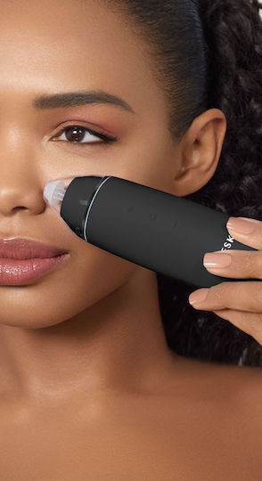 Geske Blackhead Συσκευή Καθαρισμού Προσώπου από Μαύρα Στίγματα