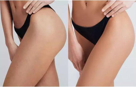 Foreo Epilator IPL pentru față, corp și bikini