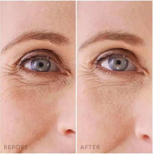 Foreo Iris Gesichtsmaske für die Augen für Feuchtigkeitsspendend 60Stück