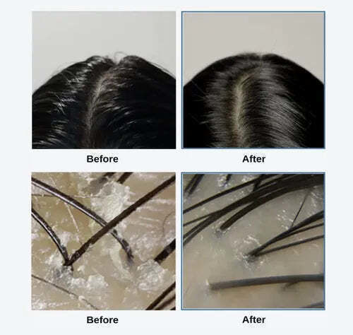 Growus Scalp Scrub για Τριχόπτωση με Νιασιναμίδη & Σαλικυλικό Οξύ 250gr