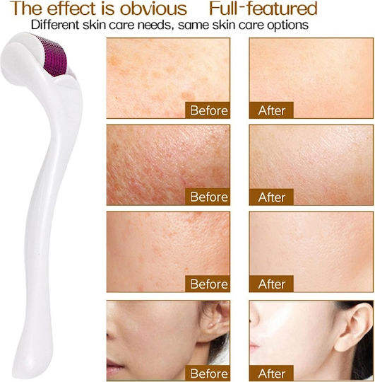 Mesotherapy Device Derma Roller Face Body 540 Needles 0.5mm White