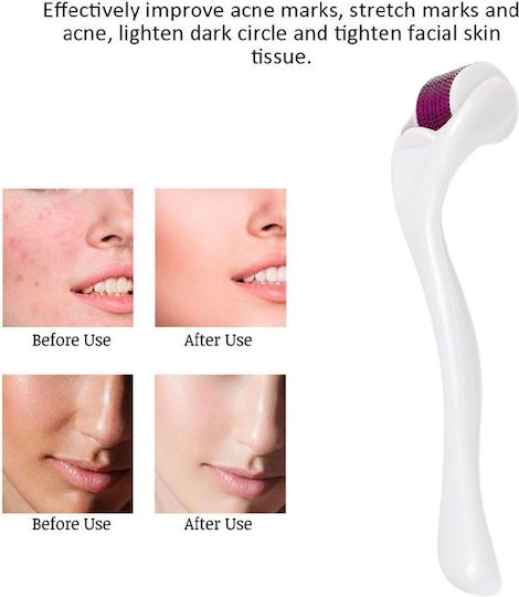 Mesotherapy Device Derma Roller Face Body 540 Needles 1.0mm White
