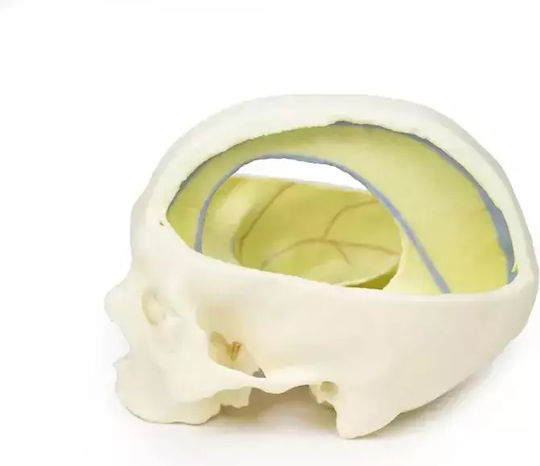 3D Schädel Harte Meningen Erler Zimmer