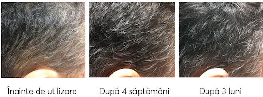 Ageless Clinic Treatment Plus Against Graying Loțiune de Păr împotriva Căderii Părului 210ml