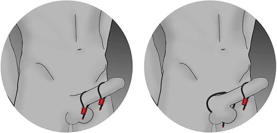 Electrastim Prestige BDSM Accessory σε Μαύρο Χρώμα