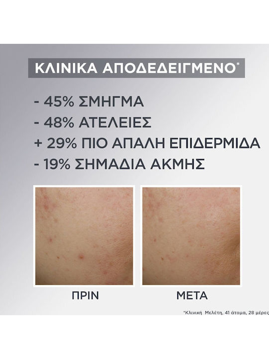 Garnier Promo Pure Active Air Face Cream Κρέμα Προσώπου Ελαφριάς Υφής Επιδερμίδες Ατέλειες 50ml & Anti Imperfection Serum 30ml & Pimple Invisible Patches Προσώπου 22 Τεμάχια