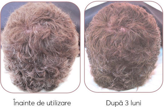 Ru:t hair Trial Seturi Pentru Par Tratamente Pentru Par Împotriva Căderii Părului Pentru Păr Vopsit Cu Șampon 3 Bucăți