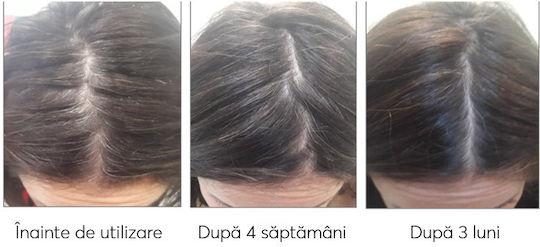 Ru:t hair Trial Seturi Pentru Par Tratamente Pentru Par Împotriva Căderii Părului Pentru Păr Vopsit Cu Șampon 3 Bucăți