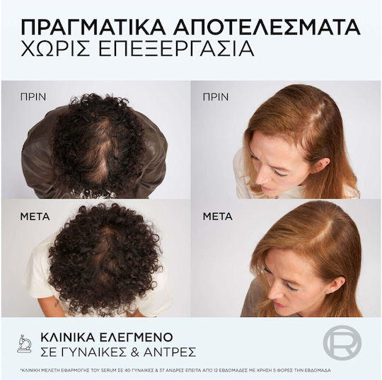 L'Oreal Paris Elvive Growth Booster Σαμπουάν κατά της Τριχόπτωσης 200ml