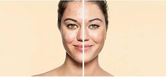 Vichy Dermablend 3D Correction Liquid Foundation 25 Nude 30ml