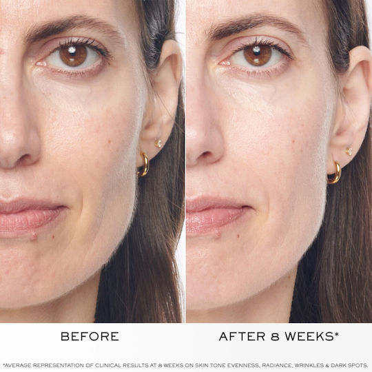 Lancome Rénergie Yeux Αντιγηραντικό Serum Ματιών με Νιασιναμίδη & Υαλουρονικό Οξύ για Σύσφιξη 20ml