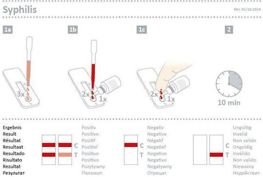 Nal Von Minden Syphilis Syphilis Antibody Detection Test 20 Pieces