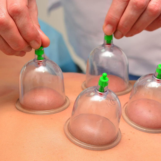 Chinesisches Vakuum Feuerlose Becher Set Pump Zellulitis Massage 12 Stück