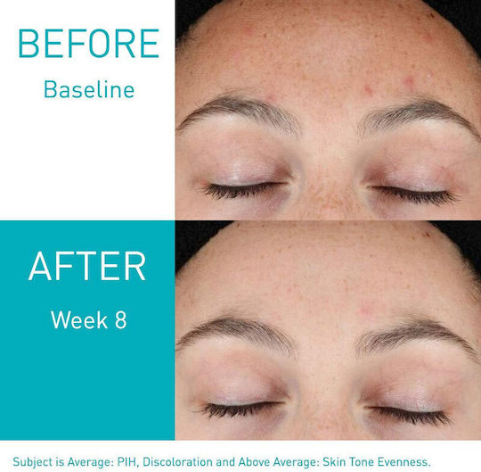 CeraVe Resurfacing Retinol Αντιγηραντικό Serum Προσώπου με Ρετινόλη & Νιασιναμίδη για Λεύκανση & Ακμή 30ml