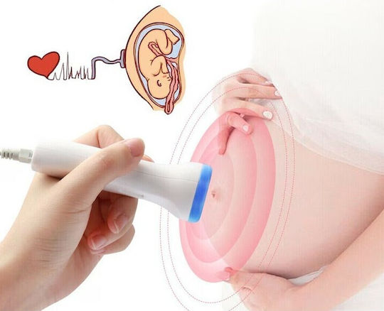 Monitor Doppler Fetal Flippy Monitorizare Sarcină Ritm Cardiac Ecran Lcd 4.5 Cm 2 X Baterii Aa Neincluse Portabil Abs 12.8 X 9.6 X 3 Cm Utilizare De La 9 Săptămâni Albastru