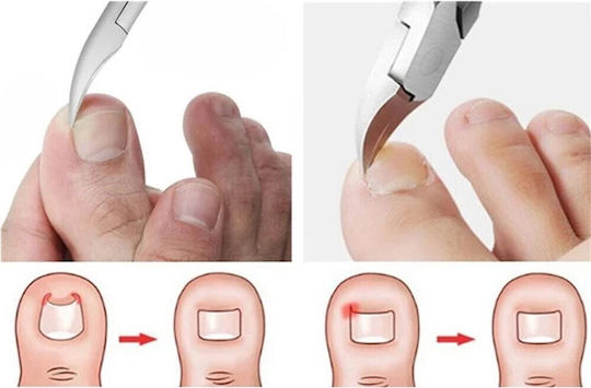 Nail Clipper Ergonomic Handles Aoyasiyue