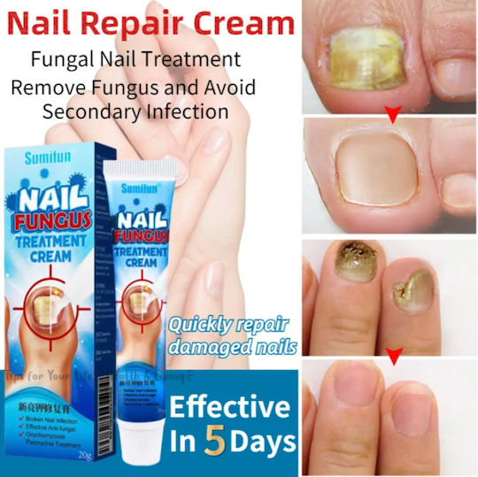 Sumifun Treatment 20gr