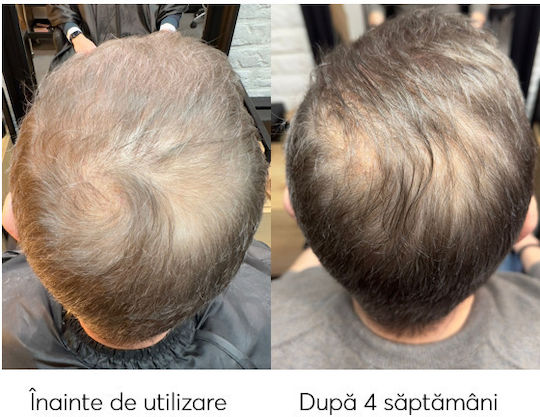 Ru:t hair Serum Pentru Scalp Împotriva Căderii Părului 100ml