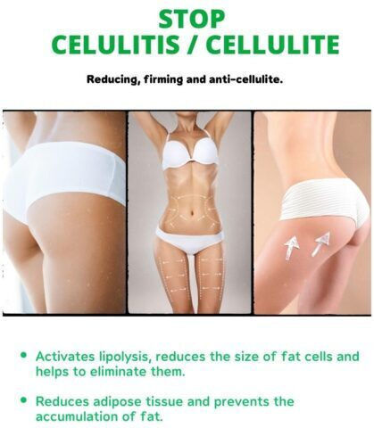 TheStopLab Stop Cellulite Cream for Slimming & Cellulite 200ml