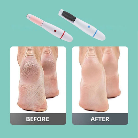 Electric Foot File Battery & USB Heels Callus Blue