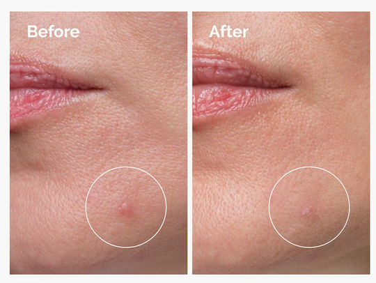 The Ordinary Sulfur 10% Powder to Cream Creme Gesicht 5gr