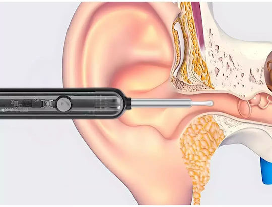 Otoscope