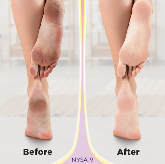 Nysa-9 Peeling / Smoothing / Revitalizing Mask for Legs